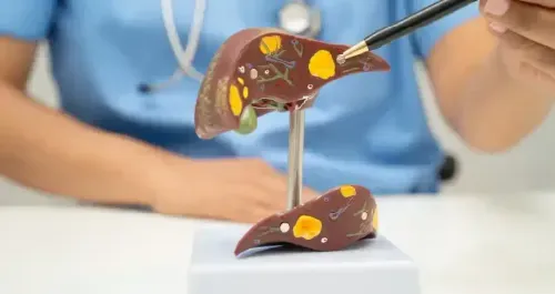 Fatty Liver: Natural Management and Lifestyle Tips
